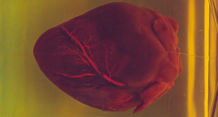 New ‘atlas’ of the heart offers new approach to treating heart disease