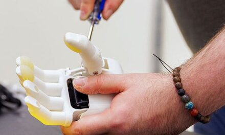 AI is revolutionizing prosthetics